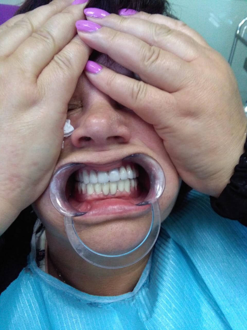 Описание пломбированиия зубов в Китае